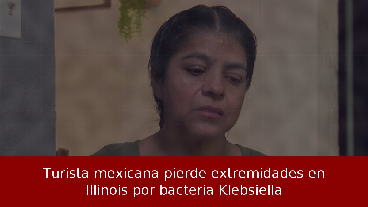 Turista mexicana pierde extremidades en Illinois por bacteria Klebsiella